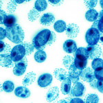 el cariotipo en la reproduccion asistida