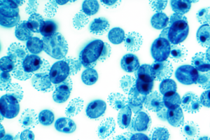 el cariotipo en la reproduccion asistida