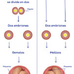 embarazo riesgo puede evitar embarazo gemelar