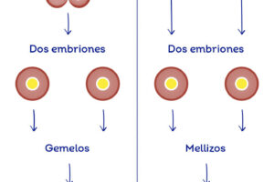 embarazo riesgo puede evitar embarazo gemelar