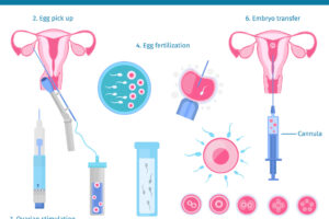 fecundación in vitro y cancer de mama