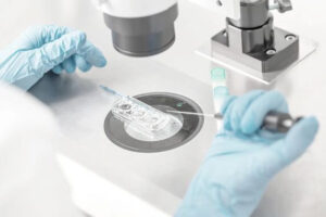 IGIN – Donación de óvulos Bilbao